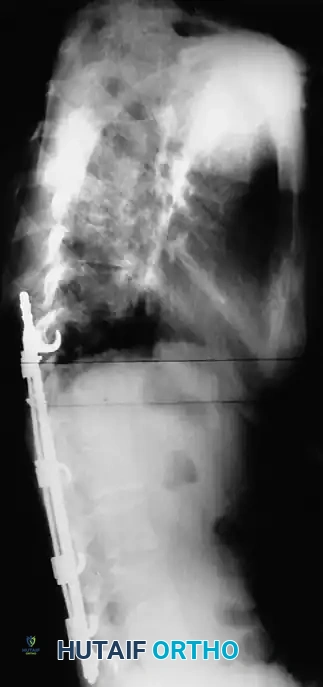 Hutaifortho's Orthopaedic Diagram