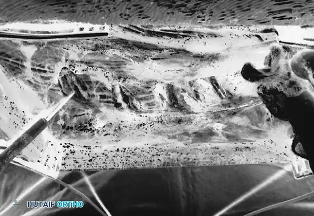 Elevator is used to pull periosteum off rib.