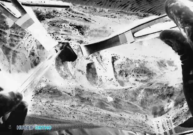 Bone wax is applied to rib ends, and Gelfoam is packed in periosteal bed.