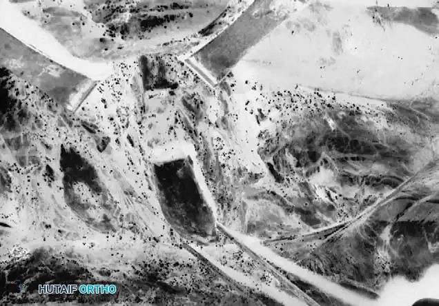 Standard rib resection, 2 cm of rib is cut initially.