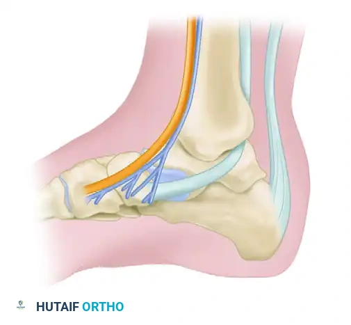 Mastering the Posteromedial Ankle Arthrotomy: Surgical Techniques and Approaches