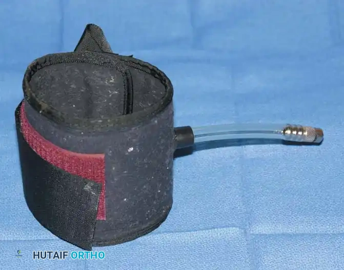 Mastering Upper Extremity Preparation, Draping, and Tourniquet Management