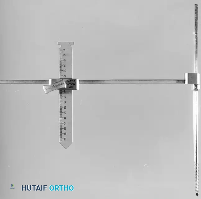 Hutaifortho's Orthopaedic Diagram