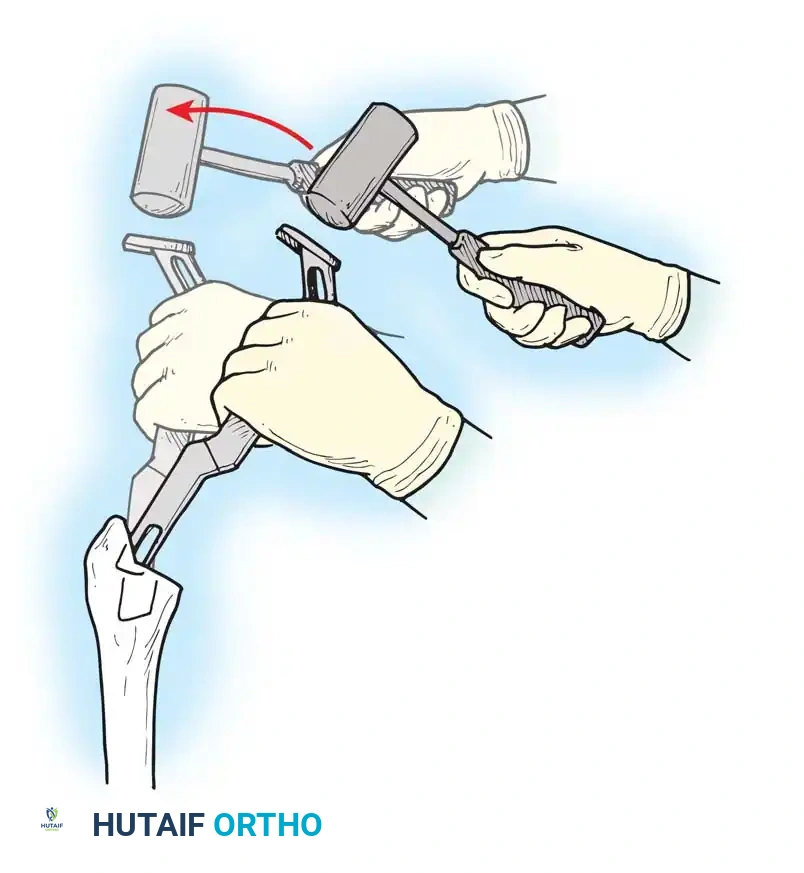 Hutaifortho's Orthopaedic Diagram