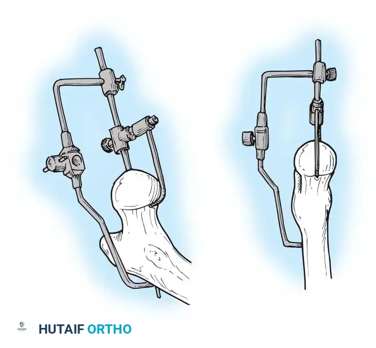 Hutaifortho's Orthopaedic Diagram