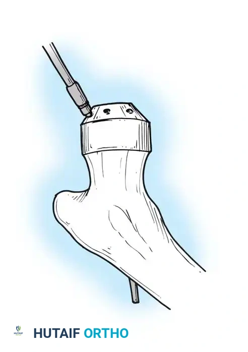 Hutaifortho's Orthopaedic Diagram