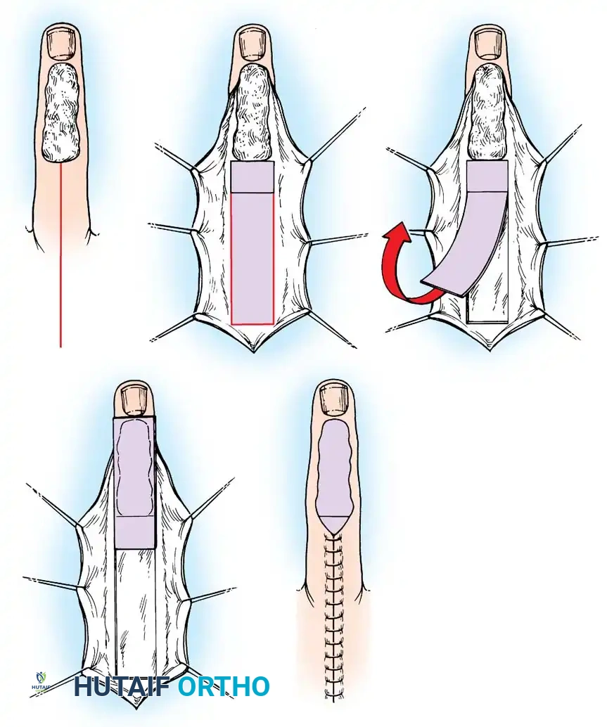 Hutaifortho's Orthopaedic Diagram