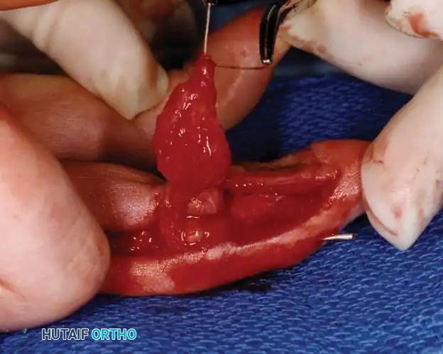 Hutaifortho's Orthopaedic Diagram