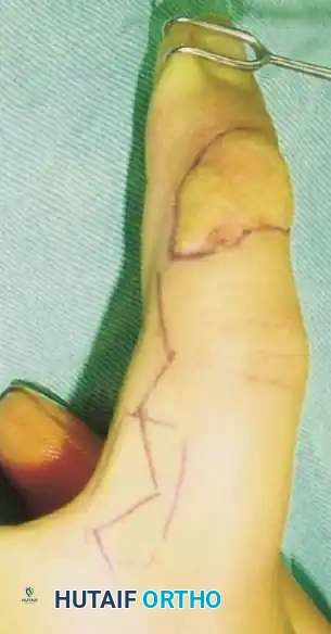 Hutaifortho's Orthopaedic Diagram