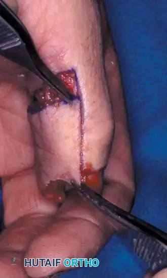 Hutaifortho's Orthopaedic Diagram