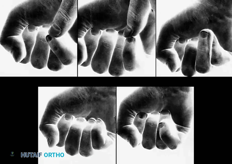 PRINCIPLES OF TREATMENT Surgical Diagram
