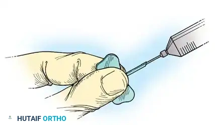 Postoperative Closure and Drainage