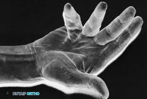 Surgical Dissection Step 3