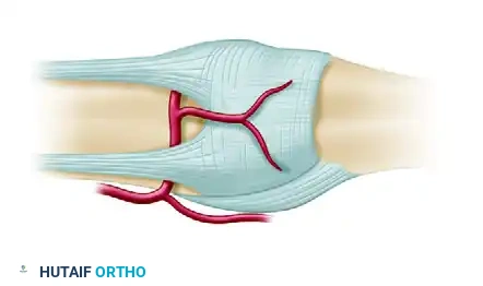 Proximal Interphalangeal Joint Capsulotomy: Surgical Guide