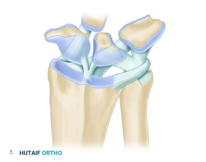 Diagnostic Radiocarpal Arthroscopy: A Comprehensive Surgical Guide