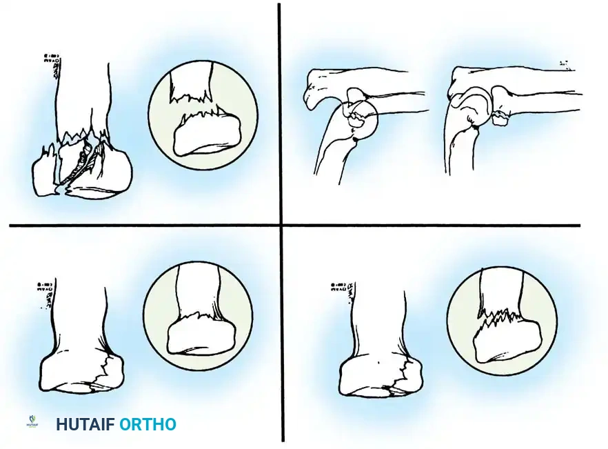 Hutaifortho's Orthopaedic Diagram