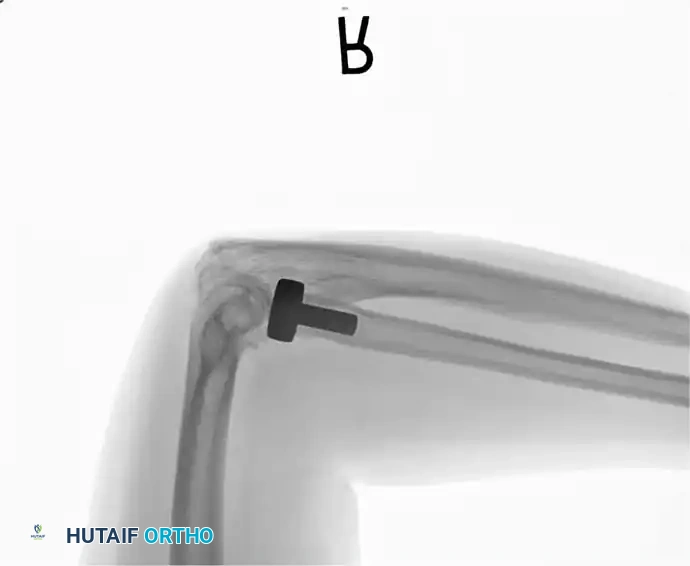 Hutaifortho's Orthopaedic Diagram