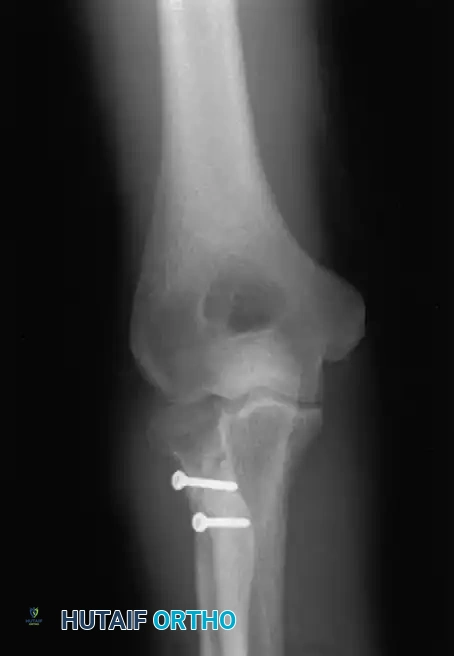 Hutaifortho's Orthopaedic Diagram
