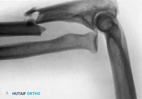 Hutaifortho's Orthopaedic Diagram