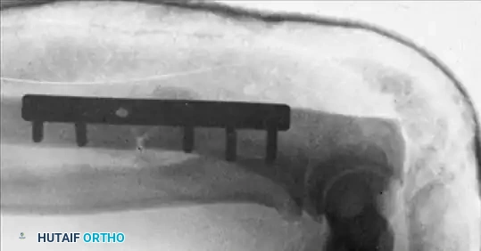 Hutaifortho's Orthopaedic Diagram