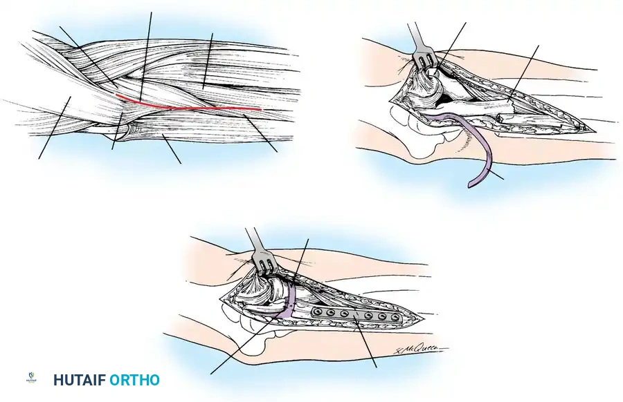 Hutaifortho's Orthopaedic Diagram