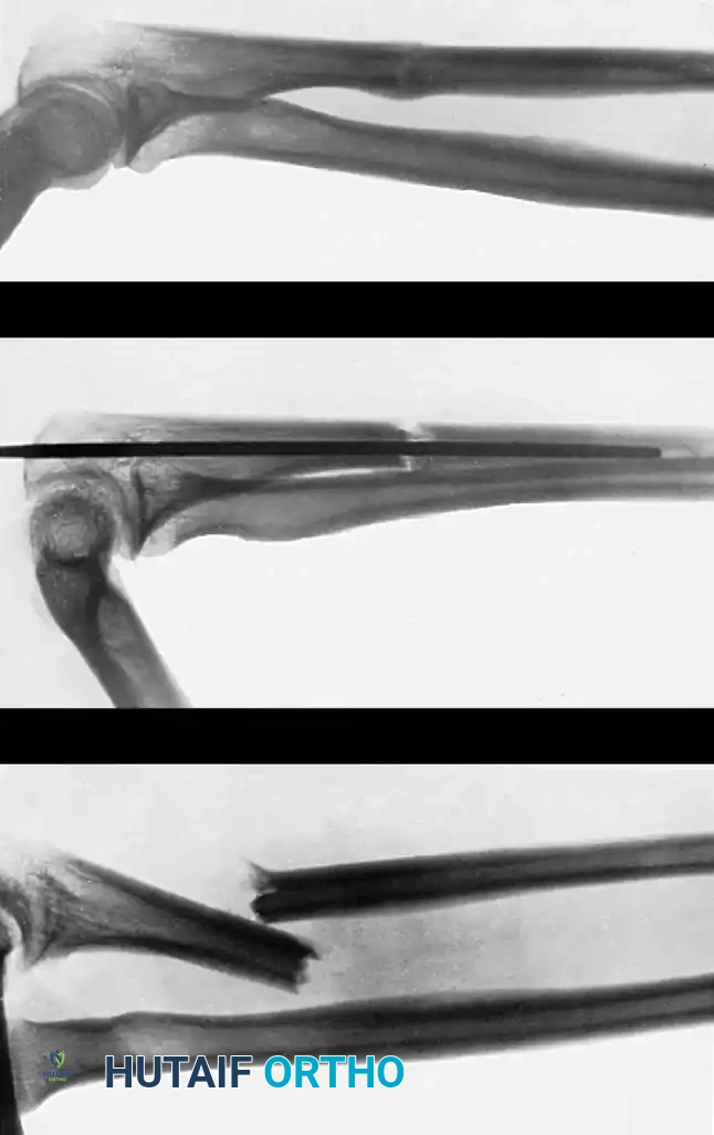 Hutaifortho's Orthopaedic Diagram