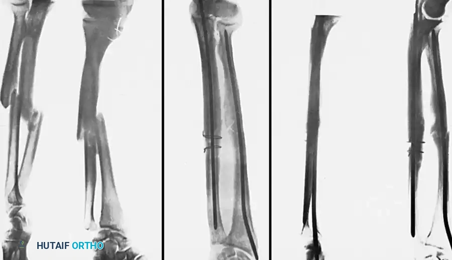 Hutaifortho's Orthopaedic Diagram