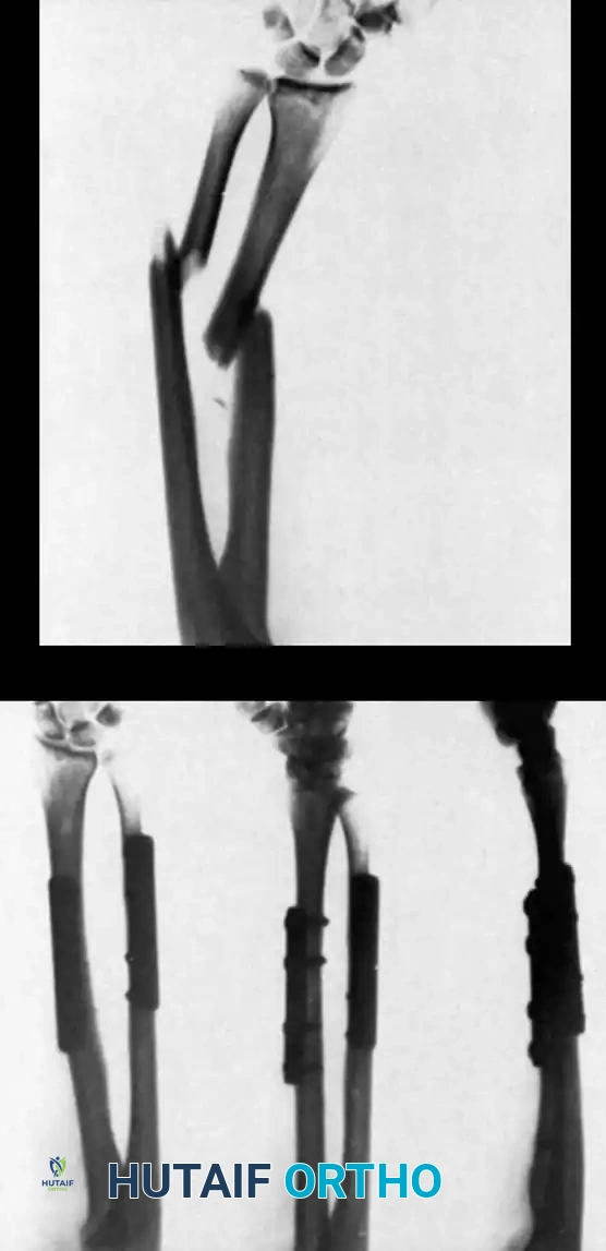 Hutaifortho's Orthopaedic Diagram