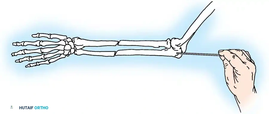 Hutaifortho's Orthopaedic Diagram