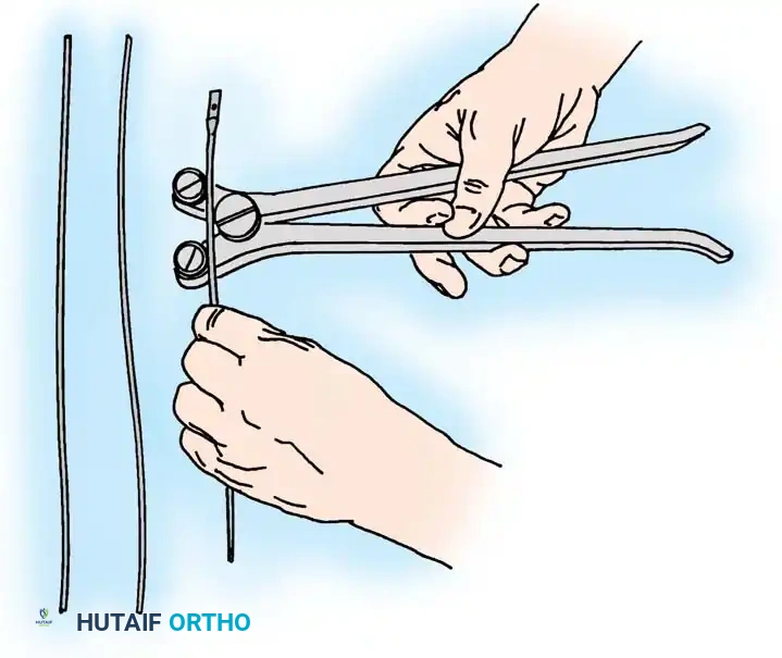 Hutaifortho's Orthopaedic Diagram
