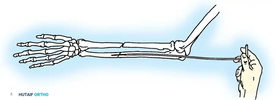 Hutaifortho's Orthopaedic Diagram