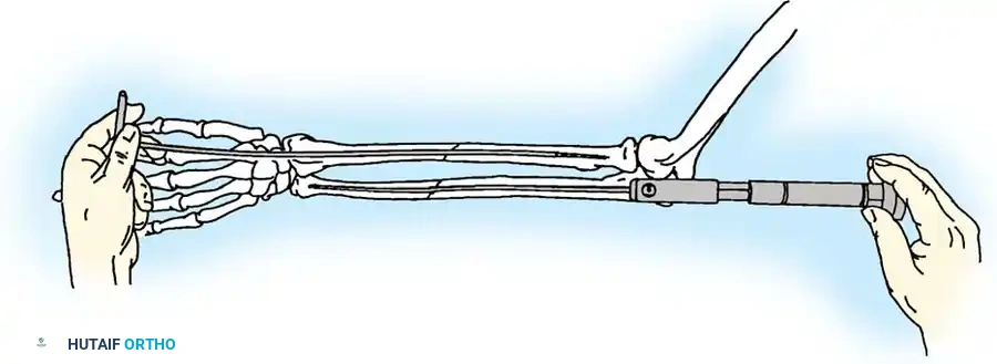 Hutaifortho's Orthopaedic Diagram