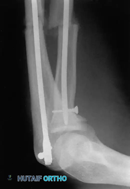 Hutaifortho's Orthopaedic Diagram