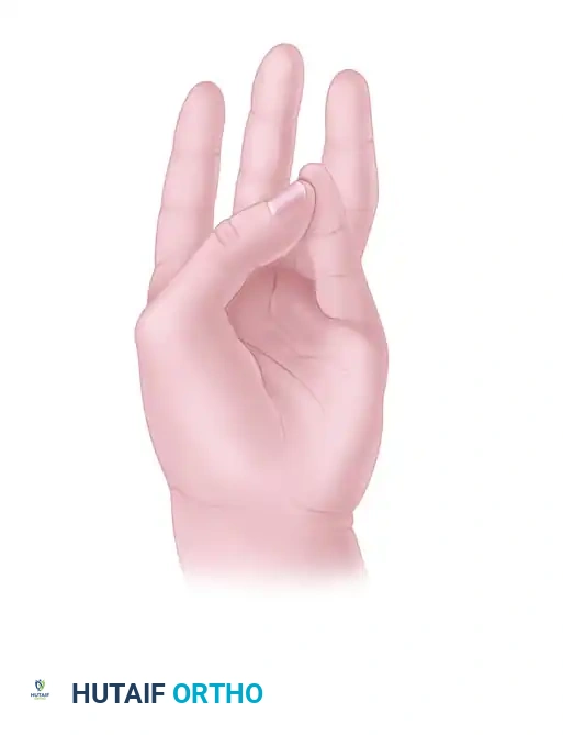 Single-Stage Flexor Tendon Grafting: Comprehensive Surgical Techniques