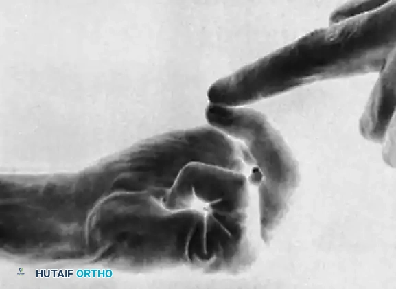 Proximal Fixation Completion