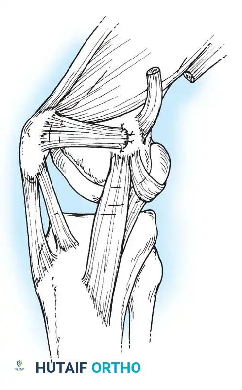 Hutaifortho's Orthopaedic Diagram