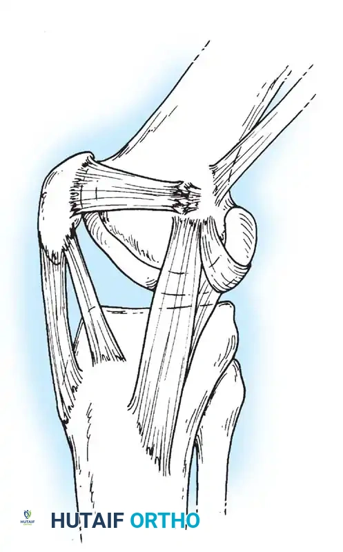 Hutaifortho's Orthopaedic Diagram
