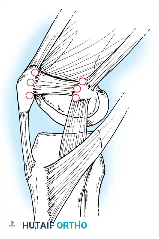 Hutaifortho's Orthopaedic Diagram