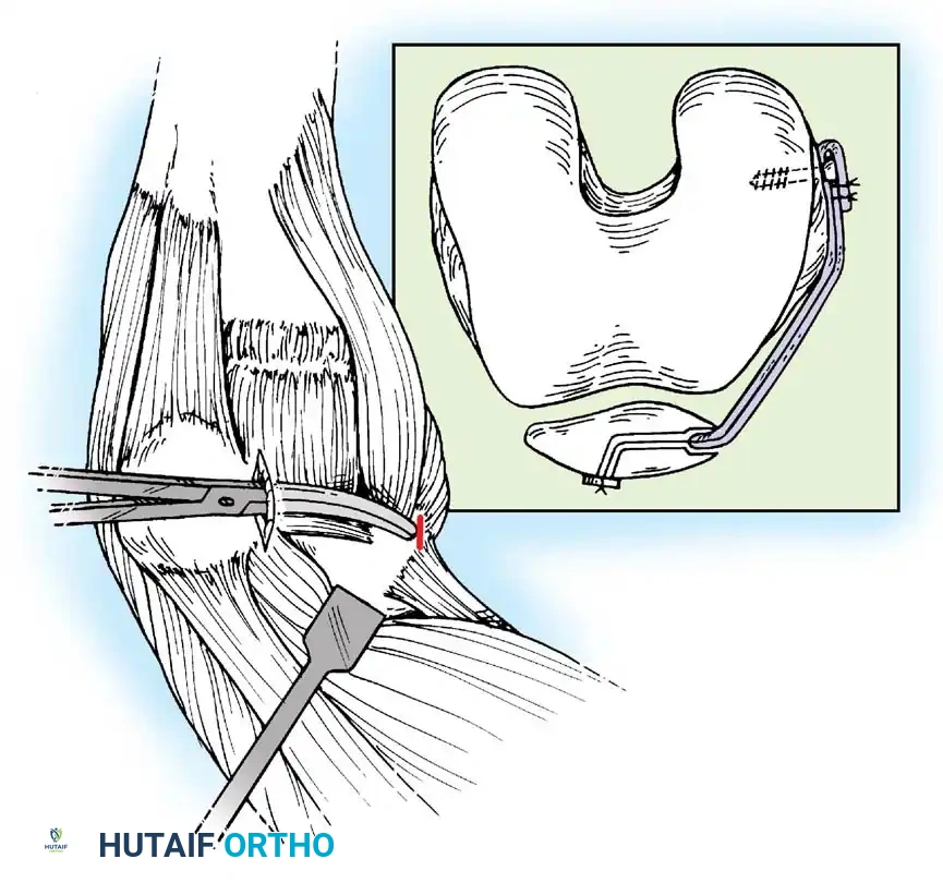 Hutaifortho's Orthopaedic Diagram