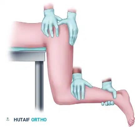 Mastering Hip Dislocation Reduction and Pipkin Fracture Management
