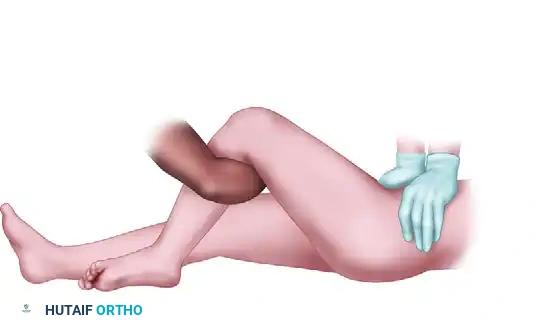 FIGURE 55-59 Stimson maneuver for reduction of hip dislocation.