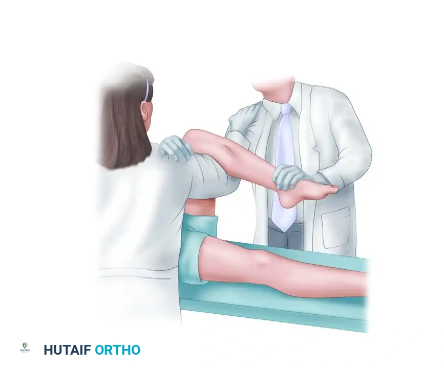 REDUCTION MANEUVERS FOR POSTERIOR HIP DISLOCATION Surgical Diagram