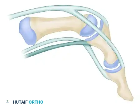 FDS Transfer Technique Completed