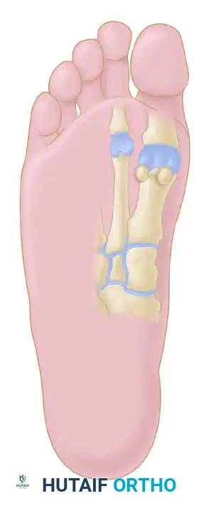 Plantar anatomy showing medial plantar nerve branches and FHL tendon