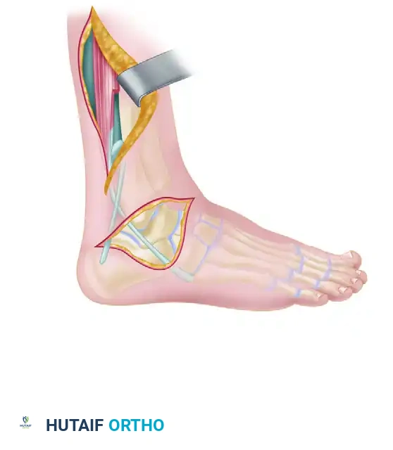 Hutaifortho's Orthopaedic Diagram