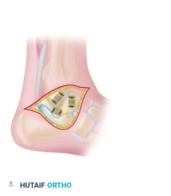 Hutaifortho's Orthopaedic Diagram