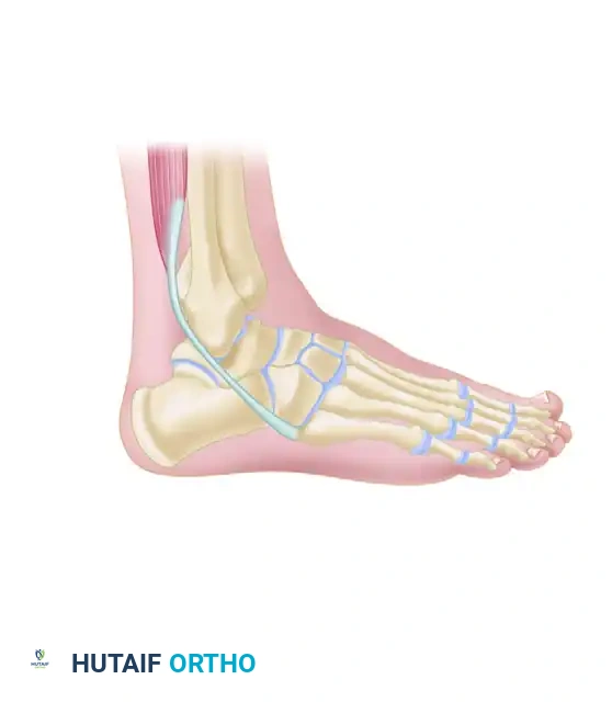 Hutaifortho's Orthopaedic Diagram