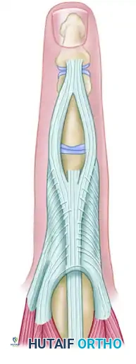 REPAIR OF CENTRAL SLIP OF THE EXTENSOR EXPANSION CAUSING BUTTONHOLE DEFORMITY Surgical Diagram