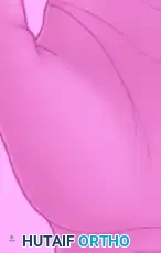 Flexor Pollicis Longus Tendon Repair: A Comprehensive Surgical Guide