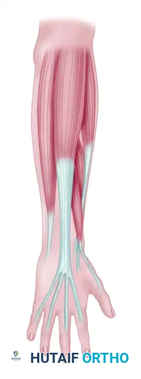 RESTORATION OF PINCH Surgical Diagram